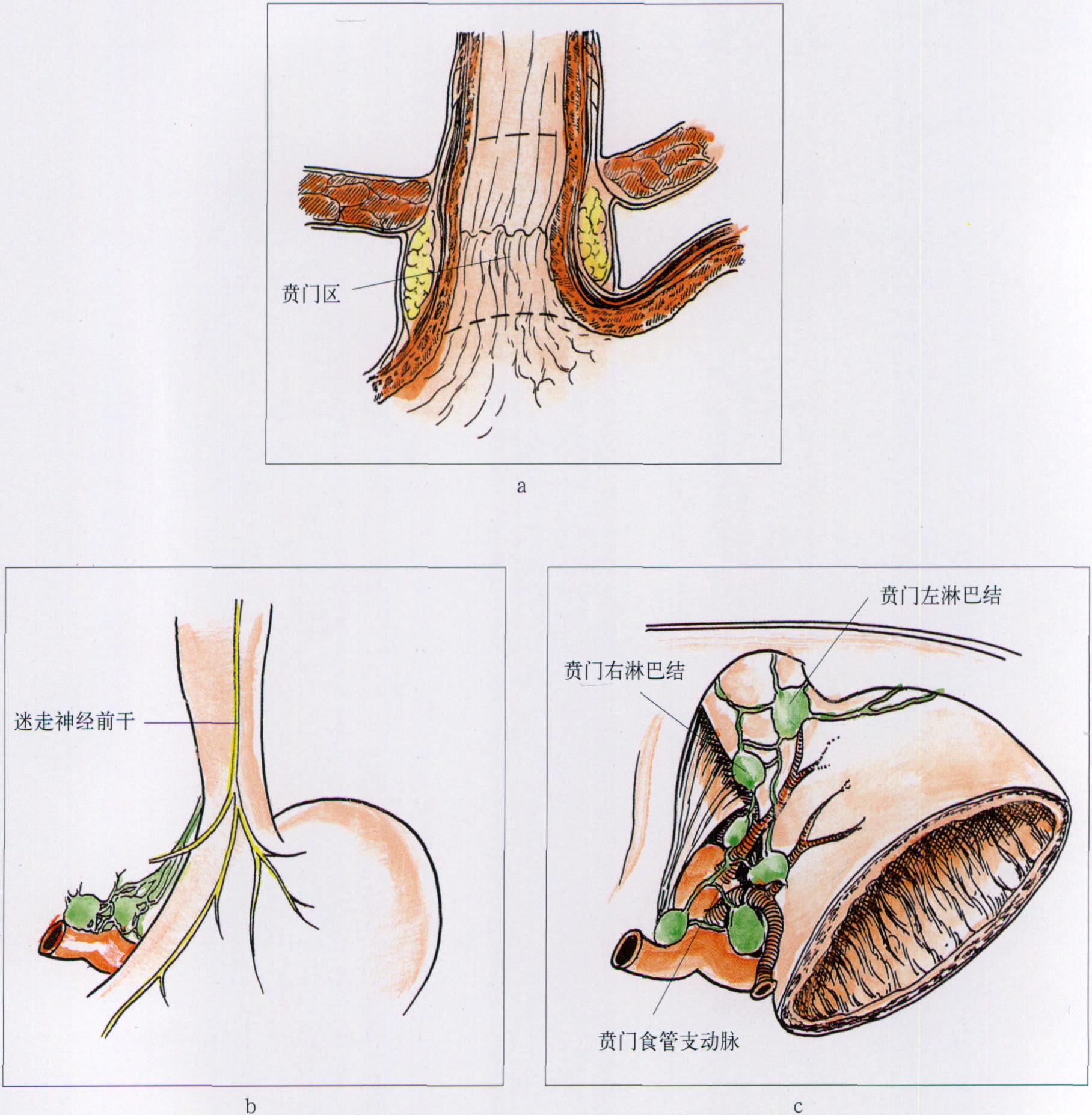 2.2 賁門(mén)